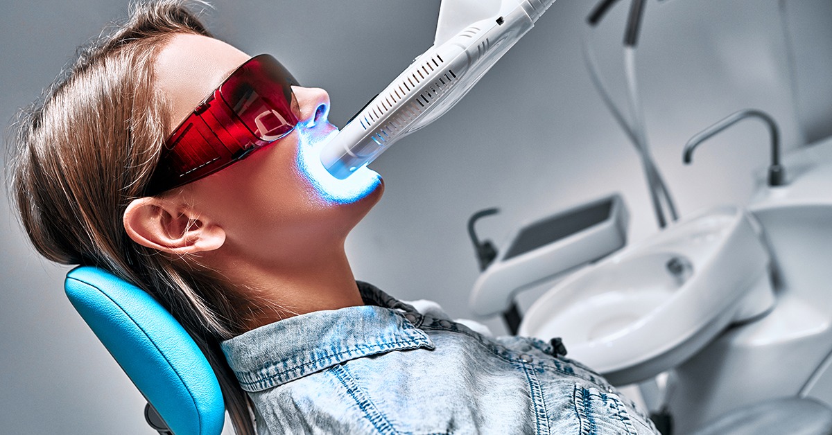 Albire dentară cu tehnologia BlancOne® + profilaxie